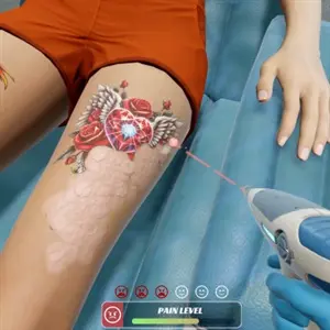 Tattoo Removal Simulator - Nivel de dolor